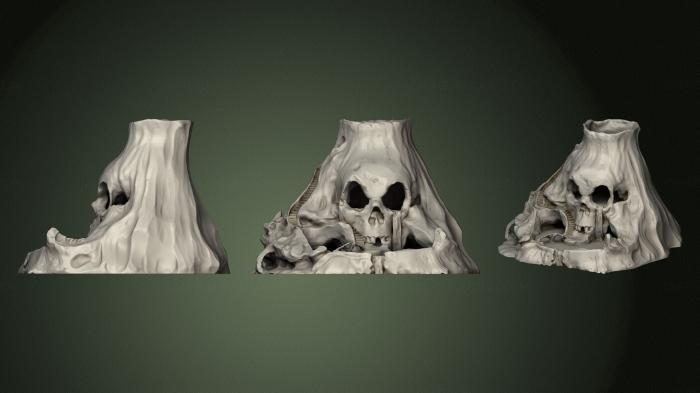 Anatomy of skeletons and skulls (ANTM_1646) 3D model for CNC machine
